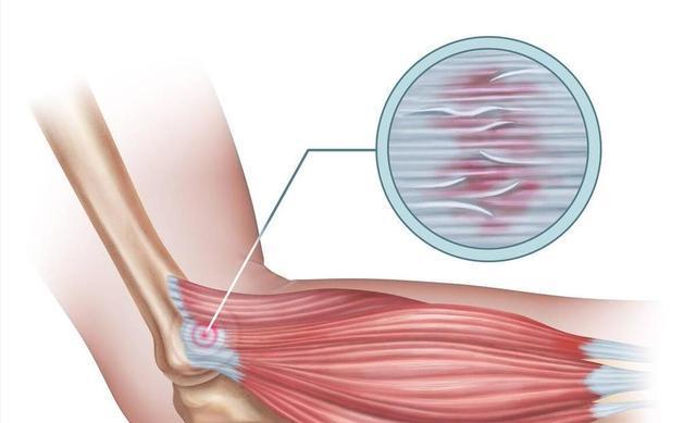 素是长期进, 冲击波治疗 素是长期进, 冲击波治疗